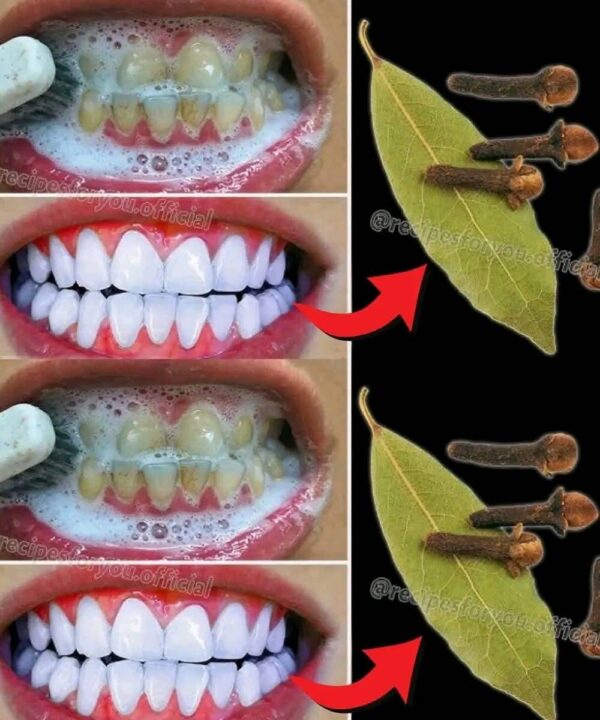 Whitening Teeth Naturally with Bay Leaves and Cloves: A Dental Tip