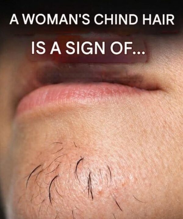 Surprising Truth About Chin Whiskers in Women
